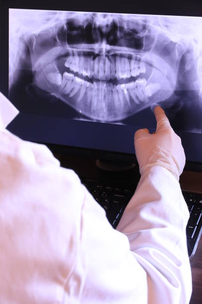 Best Knocked-Out Tooth (Avulsed Tooth) Treatment in Carmi, IL