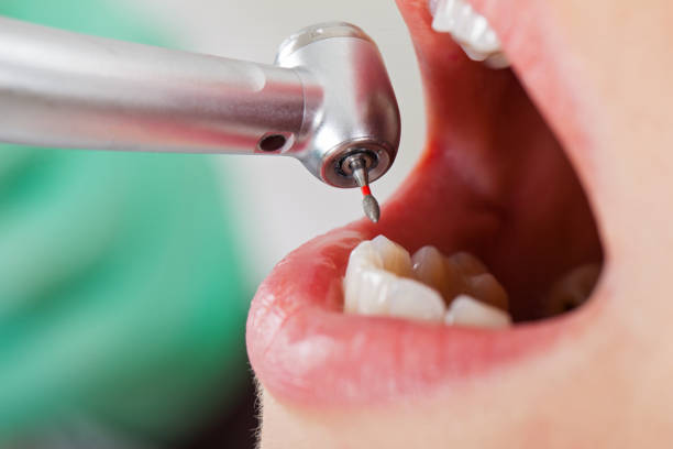 Best Weekend Emergency Dental Services in Carmi, IL